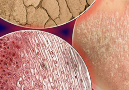 Connective Tissues